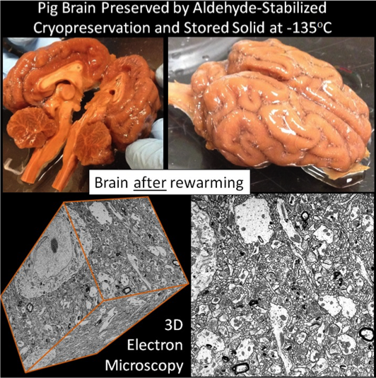 Aldehyde-stabilized cryopreserved pig brain and 3D electron microscopy of its preserved connectome