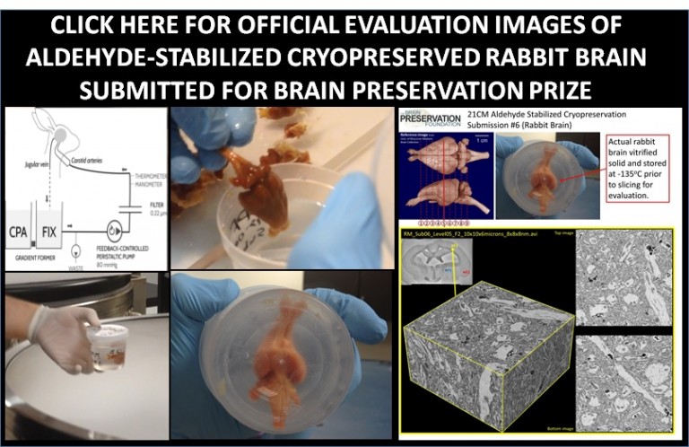 21CM Aldehyde Stabilized Cryopreservation Eval Page \u2013 The Brain ...